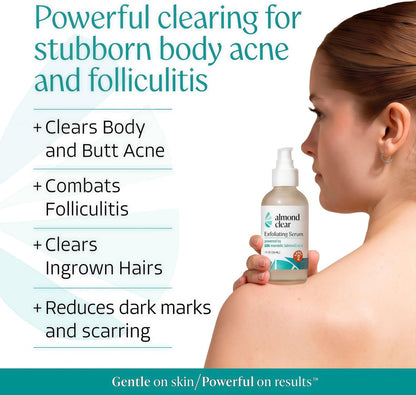 Almond Clear Mandelic Acid Level 2 Serum – Extra Strength Treatment for Body Acne, Folliculitis, and Ingrown Hairs – Buttocks Clearing Dark Spot Remover – 1 Fl Oz